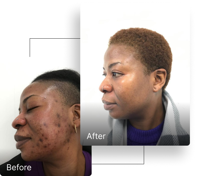 Before and after result 3