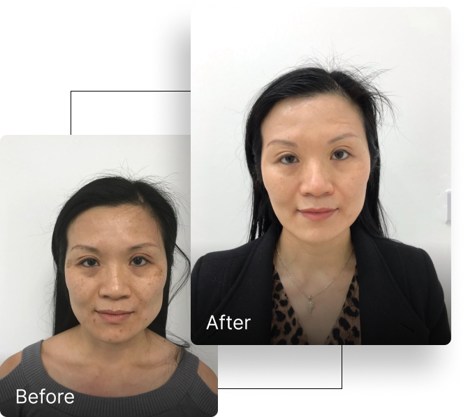 Before and after result 7