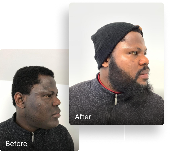 Before and after result 2