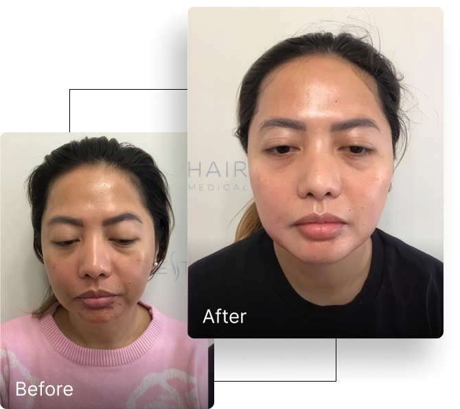 Before and after result 6